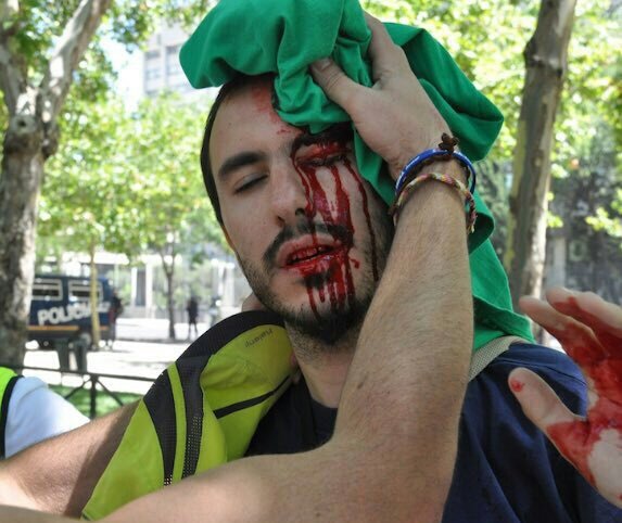 yaninasoviet's tweet photo. Heridos por la represión policial. Esto tampoco saldrá en los medios. #CatalanReferendum https://t.co/qs1hSQmgoM