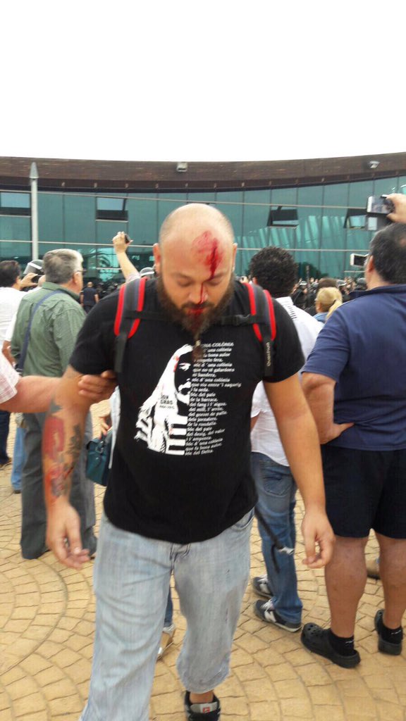 yaninasoviet's tweet photo. Heridos por la represión policial. Esto tampoco saldrá en los medios. #CatalanReferendum https://t.co/qs1hSQmgoM