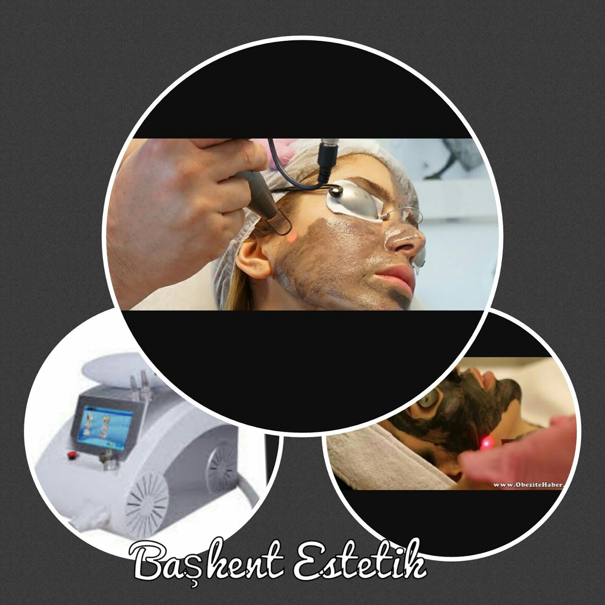 #BenDiyorumKi #başkentestetik #karbonpeeling #kampanyası #başlamıştır #ciltbakımı #güzellik #estetik #gençleşme #kırışıklık #antiaging