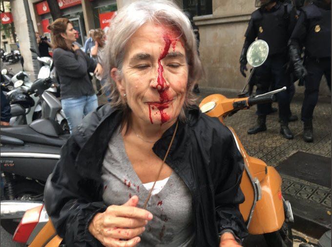 simosyd's tweet image. It's not repression of violent extremists, it's violent repression of common citizens. People who just wanted to vote. #CatalanReferendum