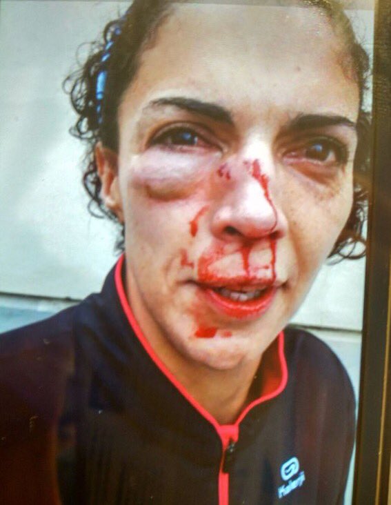 Die Antwort eines Rechtsstaats auf eine unrechtmäßige Abstimmung darf nicht das Niederprügeln seiner Bürgerinnen und Bürger sein. #Catalonia