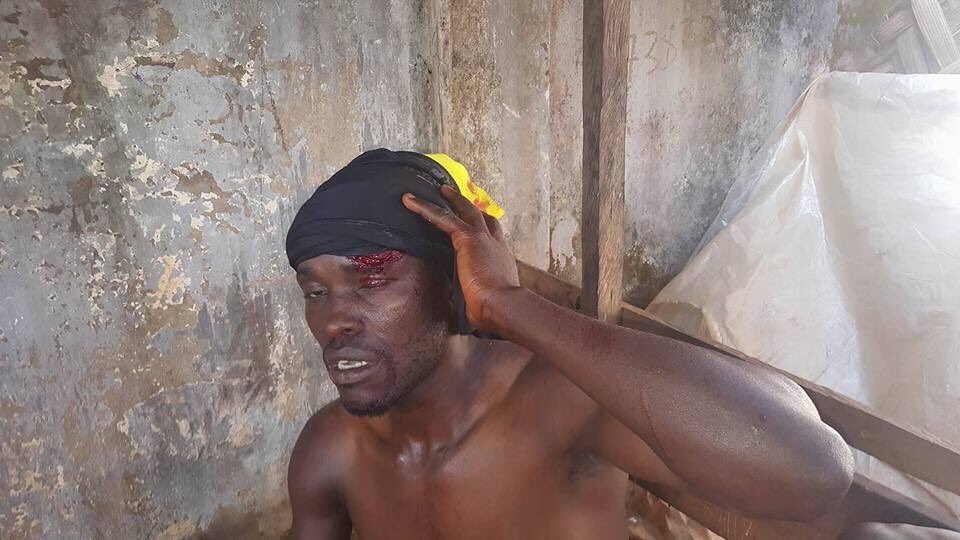 AmaboWilli50's tweet photo. @LeahHardingAJE Independence Day turns to Genocide take note @AlJazeera @BBCAfrica @antonioguterres @innercitypress we want separation https://t.co/2c6DAPasuR