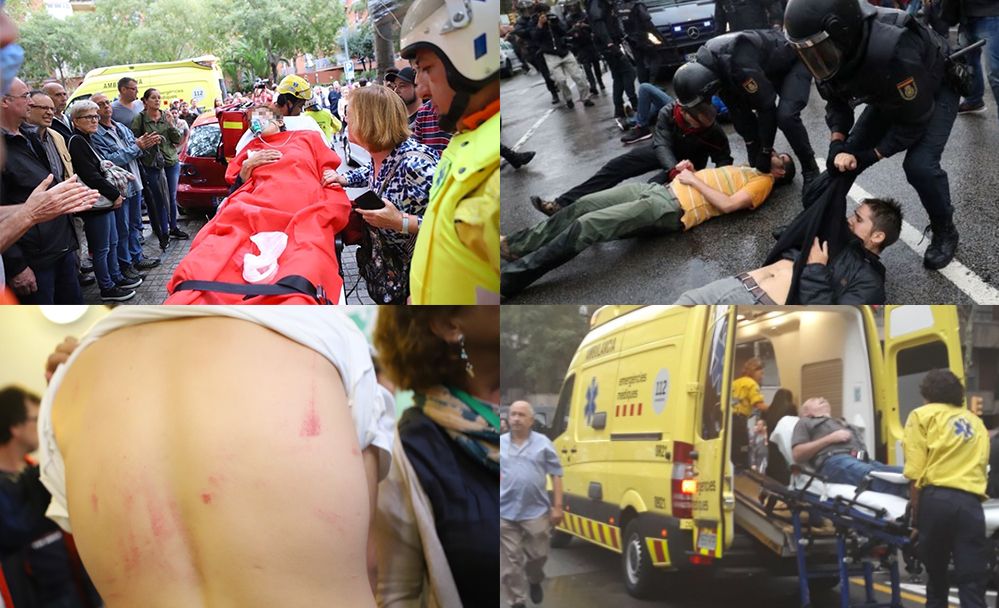 elmundotoday's tweet photo. Cientos de catalanes, ingresados con la Marca España en varias zonas del cuerpo https://t.co/OMt5tvquRl https://t.co/QWQ3NXiZyt