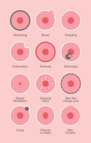 EpigeneticDS's tweet photo. It's #BreastCancerAwarenessMonth ! Do you know the signs? https://t.co/IwN2RyFPwO