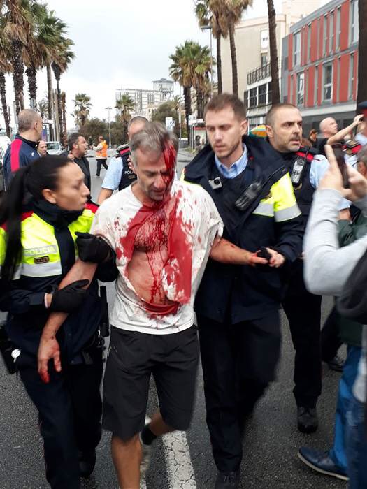 AmirAminiMD's tweet photo. Spain has chosen a rather strange strategy to convince Catalans not to leave them. 

#CatalanReferendum #CatalanReferedendum 
#vergüenza https://t.co/vKufAtMyoF