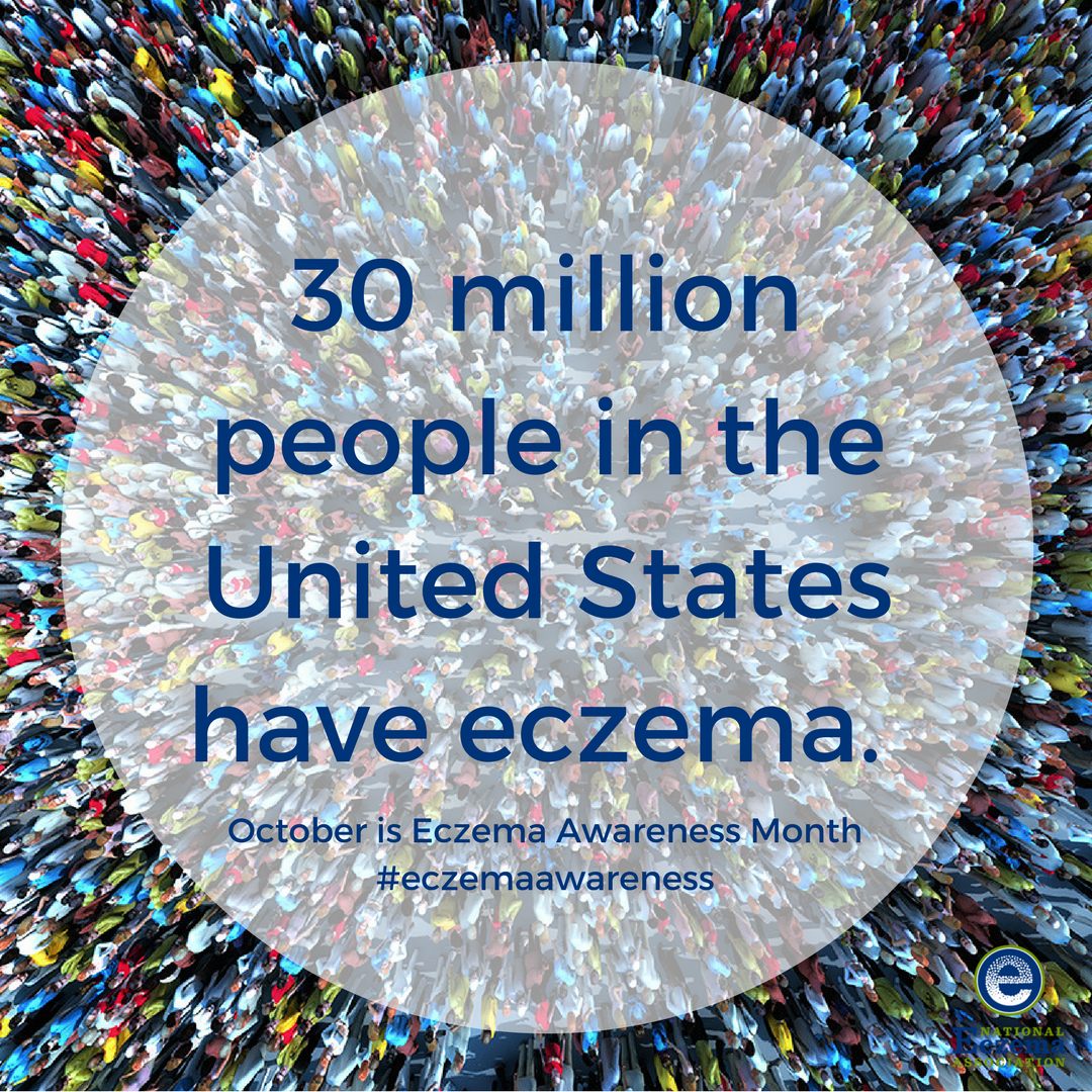National Eczema tweet media