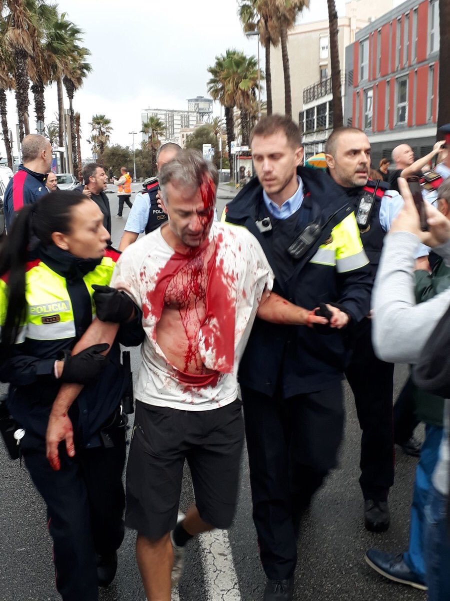 rojocasinegro61's tweet photo. #CatalanReferedendum #HemVotat 

Más de 800 HERIDOS en un referéndum NO suena a DEMOCRACIA. 

#verguenza https://t.co/dXTIXIIvfJ