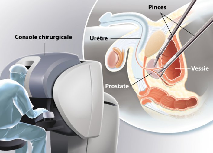 CrazyZoe_'s tweet photo. Les bienfaits du massage de la prostate, prévention du cancer. https://t.co/sKtGAHH37D https://t.co/iqKMp79Us0