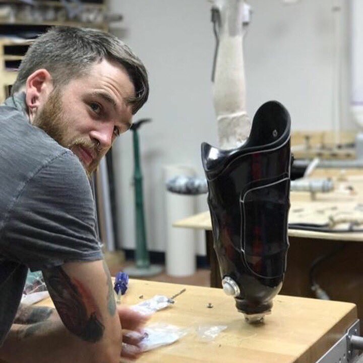 Limbionics's tweet photo. Donovan had some adventures while getting his new socket with us this weekend #walking #prosthetic #amputee #walkbetter #walkmore #newleg https://t.co/YX3YFLgKEz