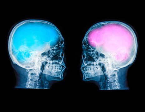 OdileRobotti's tweet photo. Combattiamo le false credenze sulle differenze di #genere che allontanano le #donne dalle carriere #STEM #YesWeSTEM https://t.co/UKOkOvILJ2 https://t.co/S3o3TgcXgY