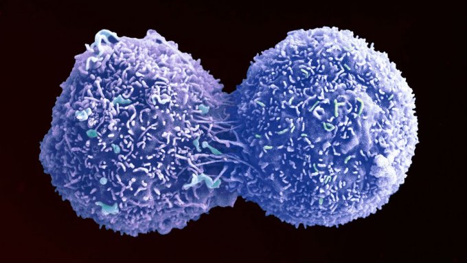 мутационная клетка. мутация клеток человека. мутации возникающие в клетках. человеческая клетка под микроскопом. мутирование клетки.