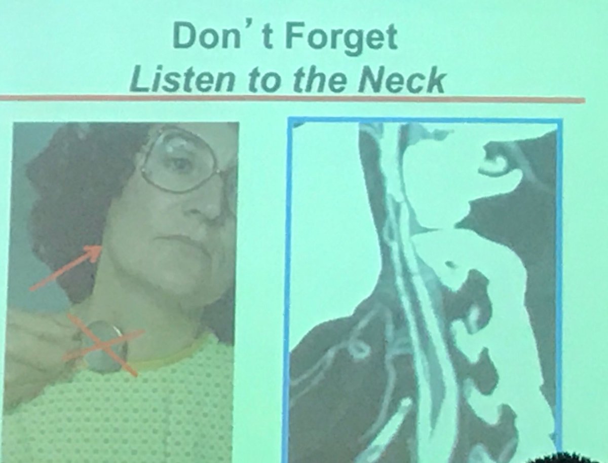 rooshaparikh's tweet photo. Listen to the neck at right place on PE. Dr. Olin's GR #FibroMuscularDysplasia #FMD @patelapurva @SlovesJan @becky_naoulou @DrMarthaGulati https://t.co/ST32aReATN