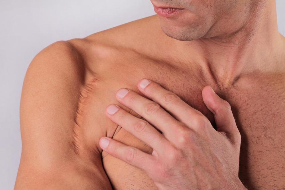 psilversteinmd's tweet photo. "Scars: Are they preventable?" via @mnt https://t.co/jY1Bvo7VPY https://t.co/VJdYAZCCcQ