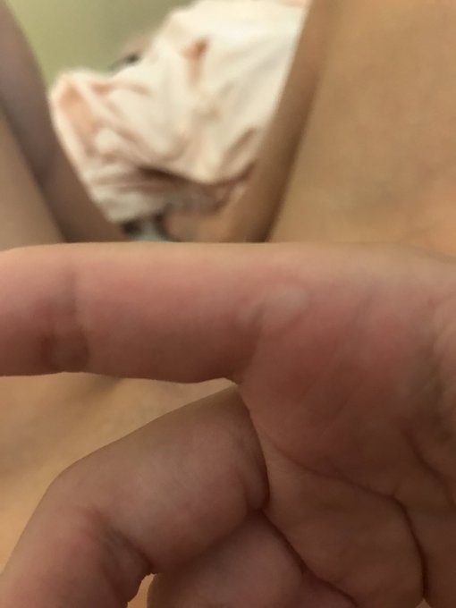 Wait..I literally just masturbated so hard I gave myself a blister  😱😱 https://t.co/I0qhVRF7Ba<a href="/tag/newprofilepic"class="tags"><span>#newprofilepic</span></a>