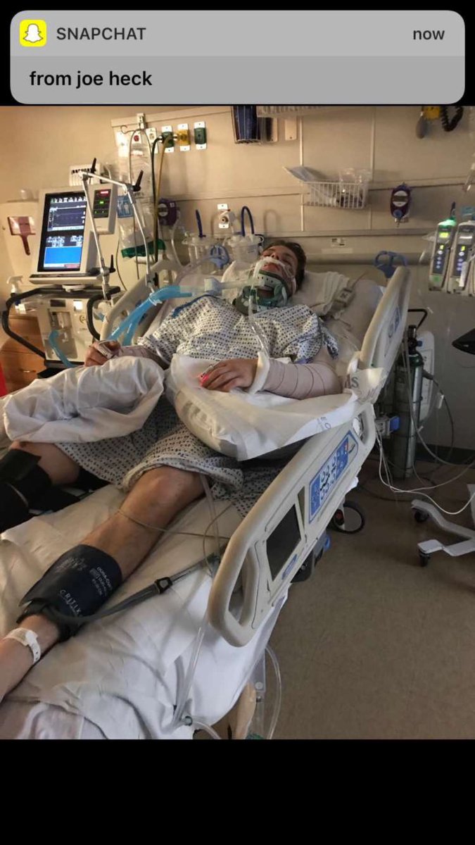 Stritzyy's tweet image. youtu.be/HslqzmBXWn4 recovery from 2 shattered elbows and broke femur @Gymshark @bpi_sports @Team_Optimum @BSNSupplements @TeamGaspari