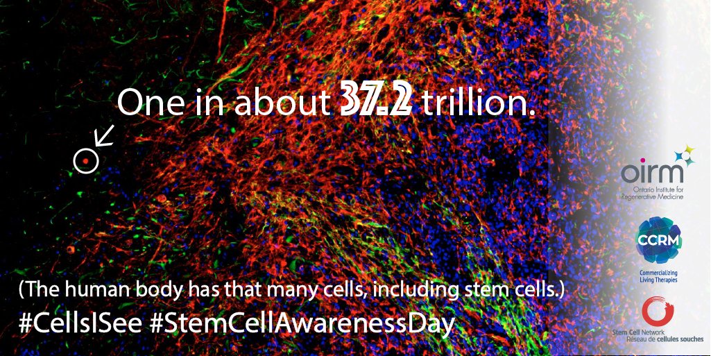 OIRMnews's tweet photo. More about stem cells: https://t.co/gonDNbZCze &amp; stem cell therapies: https://t.co/UtOVza44FA #stemcellawarenessday @ISSCR @CaulfieldTim https://t.co/v8wnyyeSio