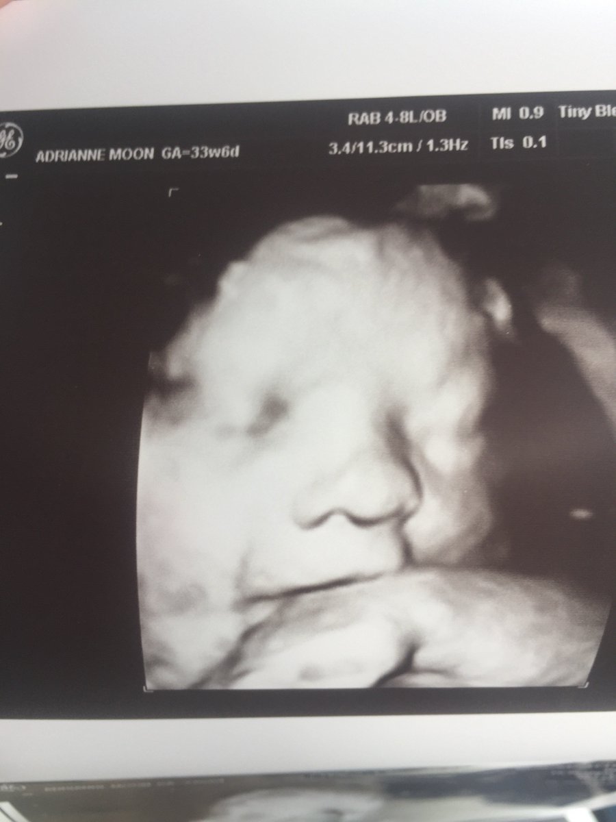 That little smirk. I can't 🙈🙈😍😍🤗 #6weeks