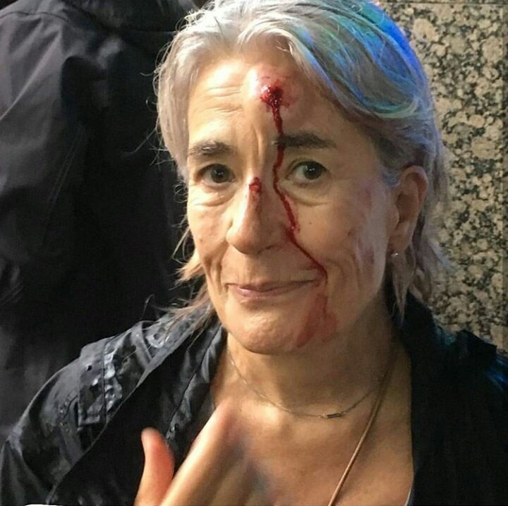gtk_sb's tweet photo. Para los insustanciales que decíais que la sangre de esta señora era falsa!!!  #VagaGeneral30 https://t.co/orUxgZyz8U