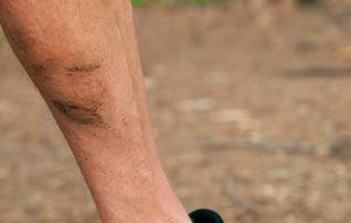 runnersworld's tweet photo. This is the telltale sign you have a weak butt and hips https://t.co/INy3jvCkNF https://t.co/iVqNP09FIB