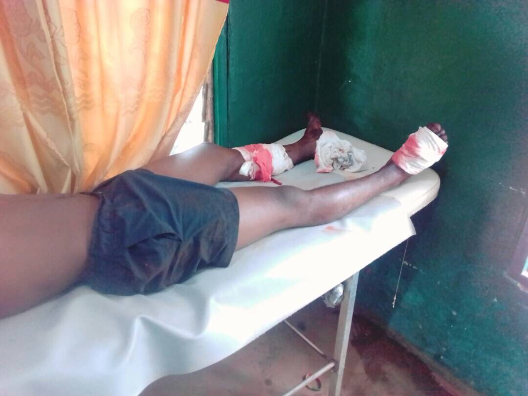 Clotildess2's tweet photo. #Cameroon shoot our legs, we shall crawl to the finish line by all means #freesouthernCameroons @UN @antonioguterres @BBCAfrica @CNNAfrica https://t.co/UhG30MO6r0