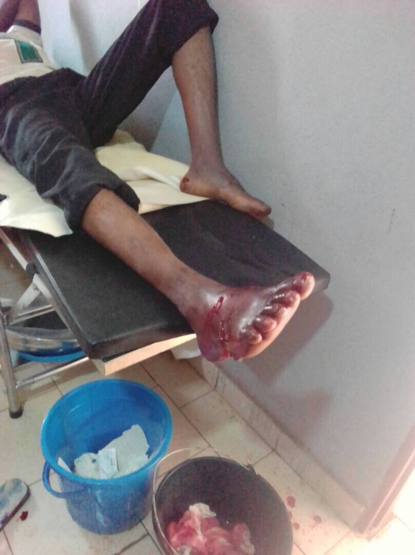 Clotildess2's tweet photo. #Cameroon shoot our legs, we shall crawl to the finish line by all means #freesouthernCameroons @UN @antonioguterres @BBCAfrica @CNNAfrica https://t.co/UhG30MO6r0