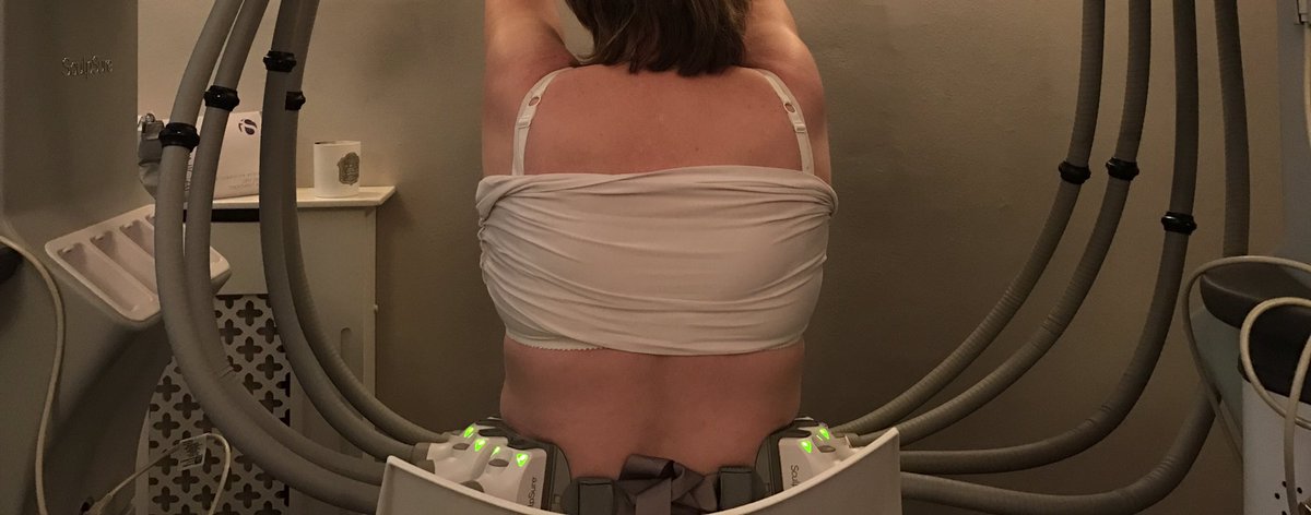 MissBalaratnam's tweet photo. A great mix of treatments in clinic today #consults #VISIA #dermalfillers @SculpSure #DualSculpt @HydraFacialUK @iSCLINICALUK #skincare #ICON #laser @ThreeForMeSkin #ilovemyjob #Beaconsfield #naturalresults https://t.co/UXwXfTUXfi