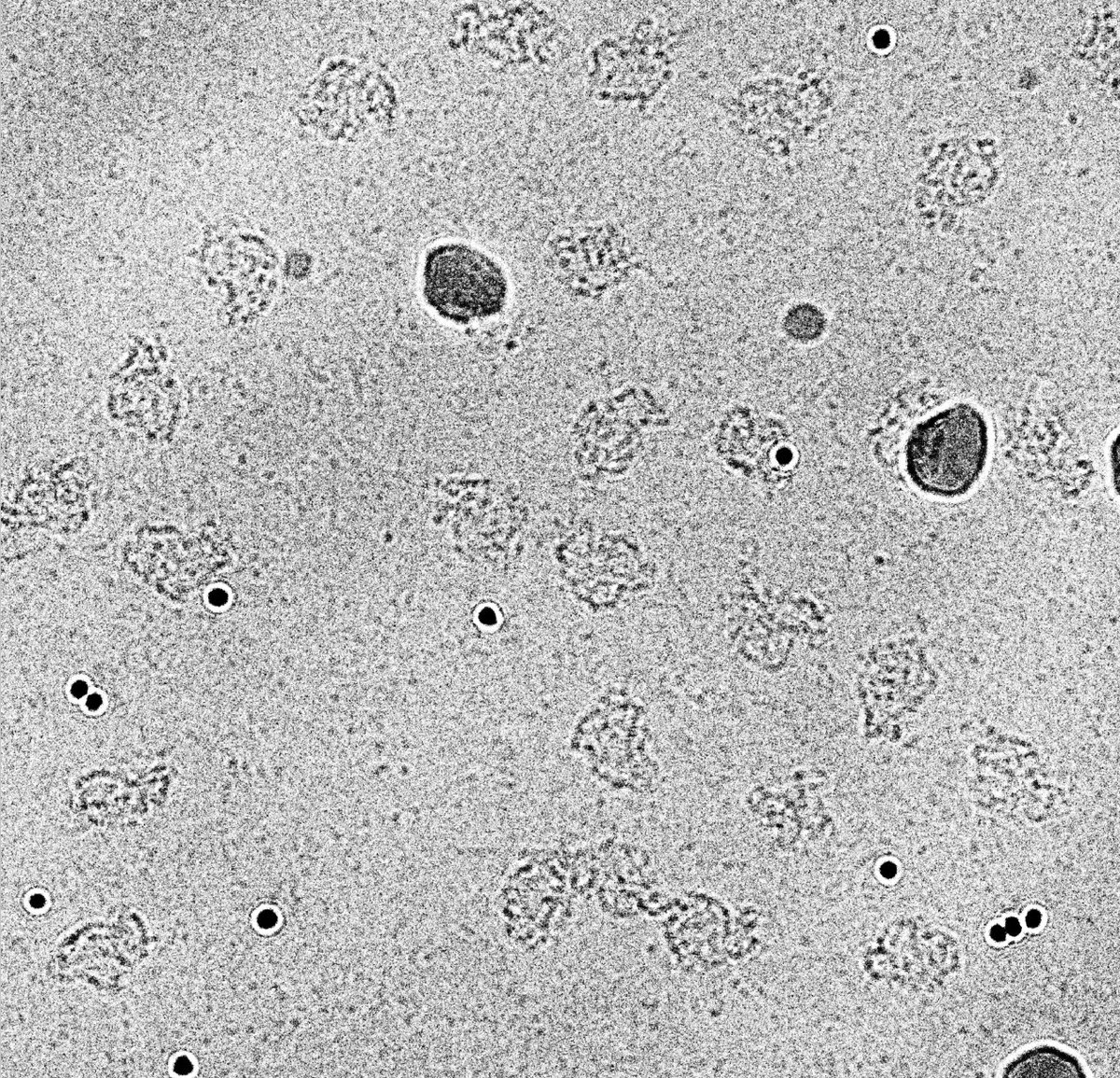 dynaspacerMSCA's tweet photo. Yes, @NobelPrize, CryoEM is cool! Here some bunny shaped structures observed with this technique. Here the paper https://t.co/XELWml6qYB https://t.co/apCw3Dg0kP