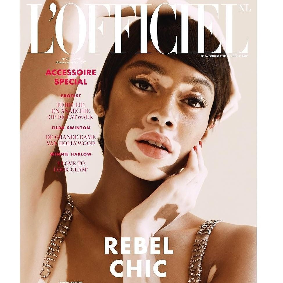 Love <a href="/winnieharlow/">♔Winnie Harlow♔</a> 4  <a href="/lofficielnl/">L'OfficielNL</a> (Dutch L'Officiel) oct/nov '17. We need diversity in fashion &amp; magazines #Diversityrules #beautyisdiverse