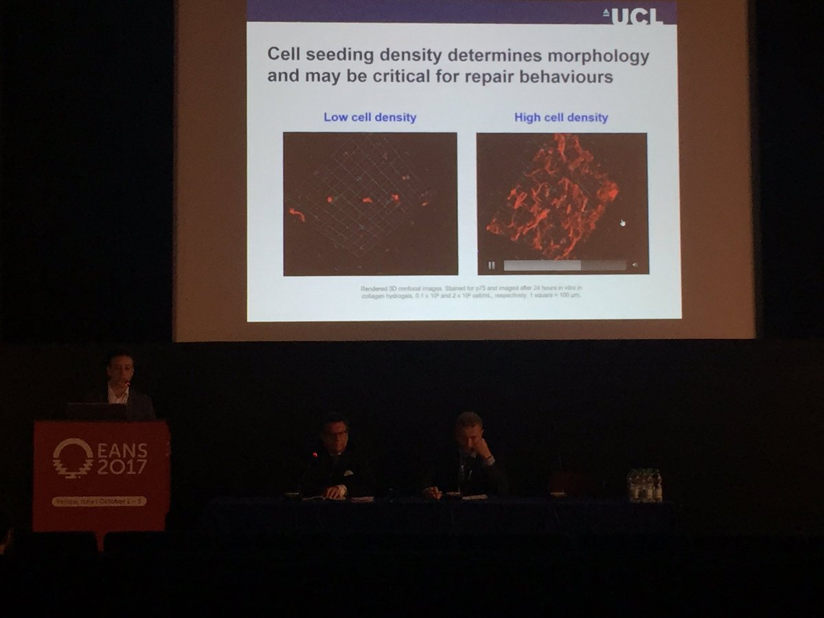vittoriostumpo_'s tweet photo. My friend @drrdb93 presenting his research carried out at @UCL_MBPhD at #EANS2017 @EANSonline. Outstanding presentation! https://t.co/LzDlgp1GO0