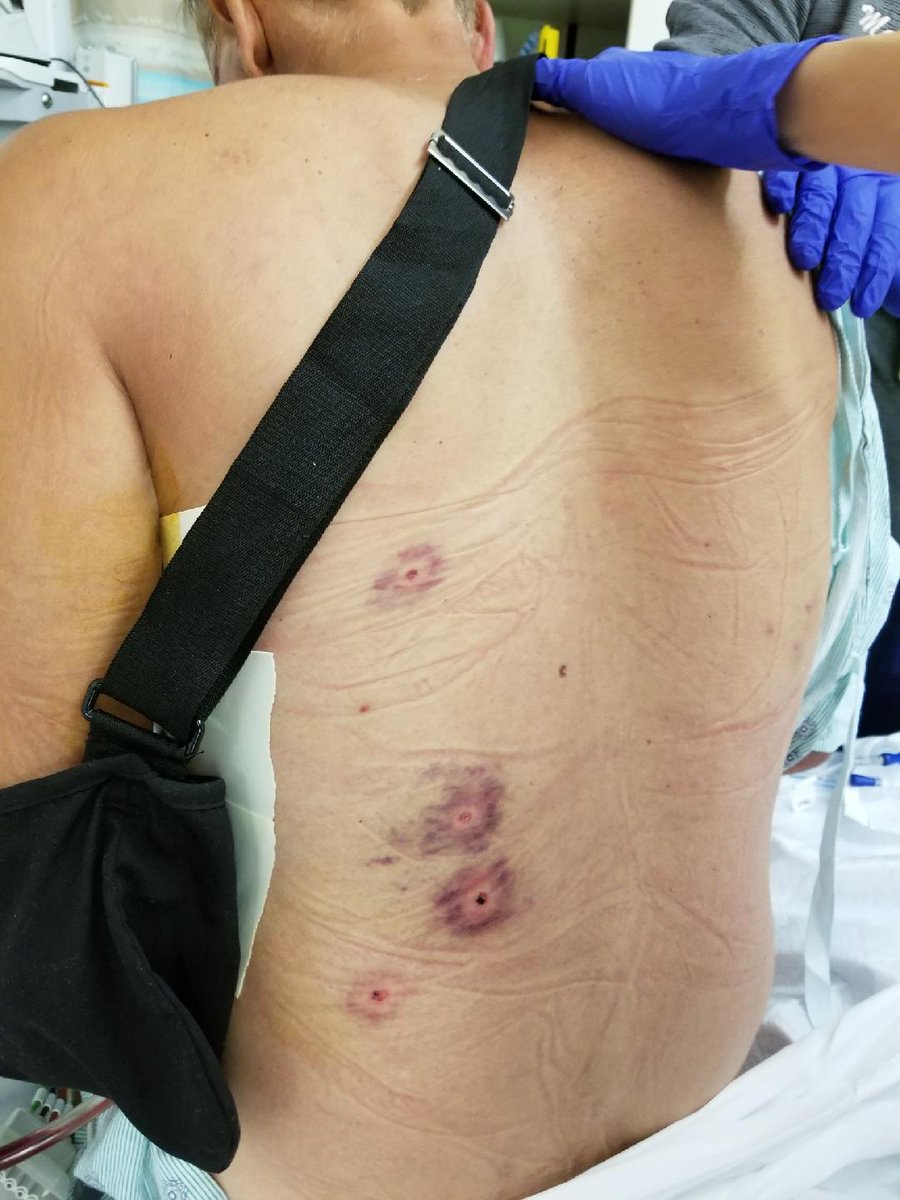 AllysonBlairTV's tweet photo. A Maili grandfather was beaten &amp; shot w/ a pellet gun in brutal beach park attack. At 6p find out who he says is responsible @HawaiiNewsNow https://t.co/HvyR5PAqSR