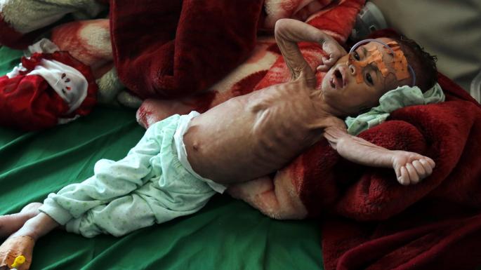 The UN has put Saudi Arabia on a human rights blacklist for killing and maiming children in Yemen thetim.es/2fSbPub