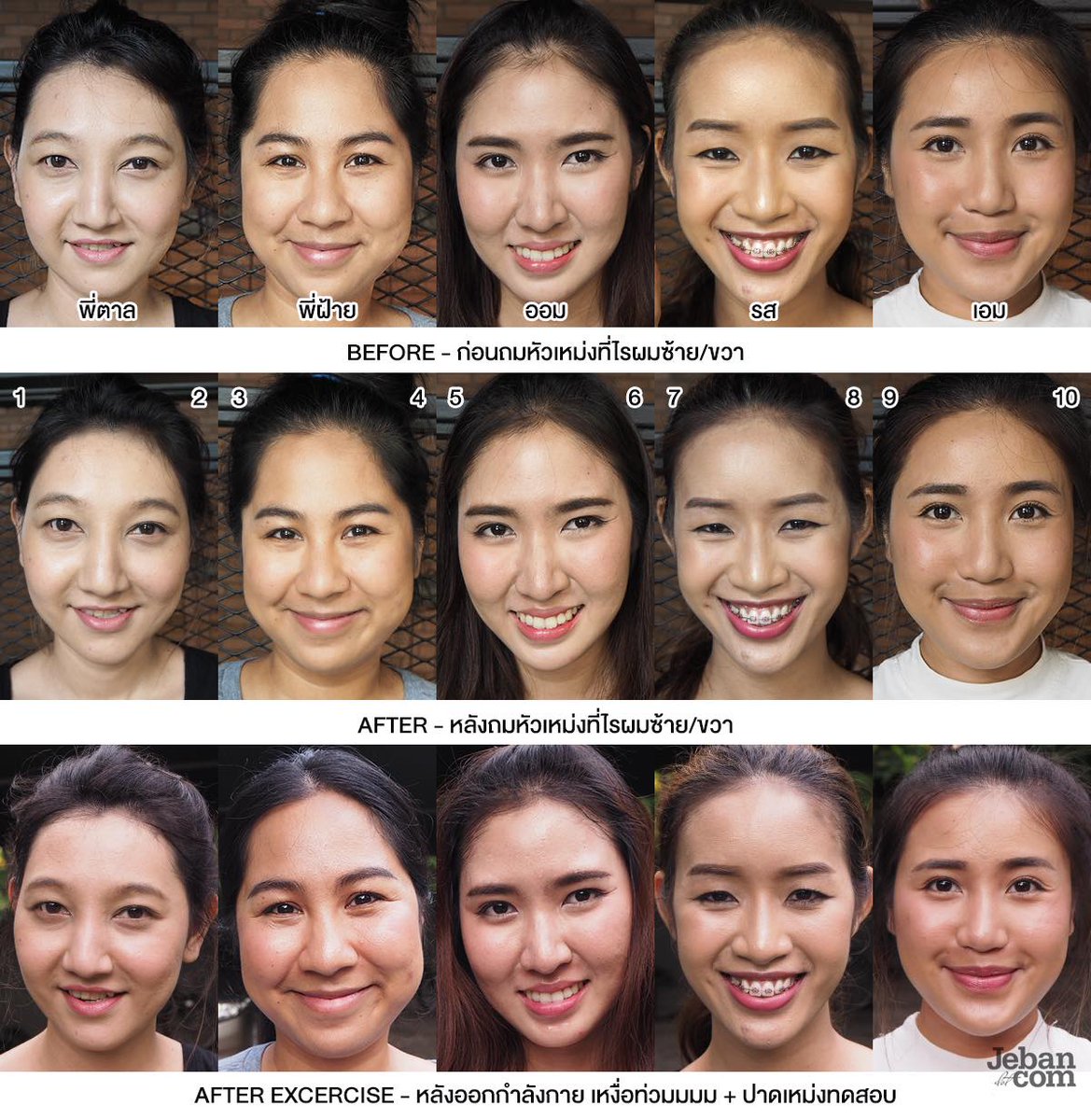 JebanSundae's tweet photo. เร่เข้ามาจ้าา ใครมีเหม่งคือต้องดูวว #JEBANLAB เทสต์ 10 ไอเท็มถมเหม่ง ปัญหาหัวเหม่ง ผมบาง จะไม่ใช่เรื่องใหญ่อีกต่อไปล้าวว 55555 😎😎😎
#ดีบอกต่อ https://t.co/cVa0NOAOhR