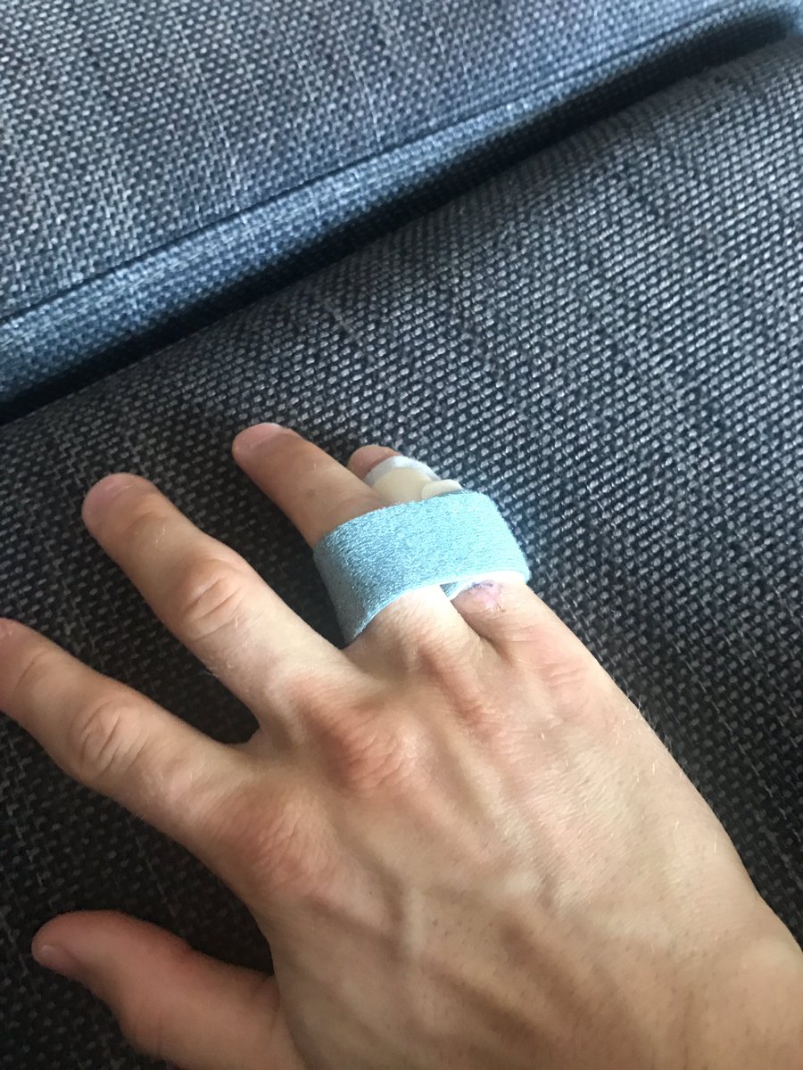 Bra skönt utan gips!