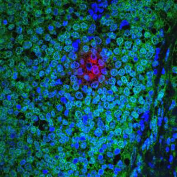 AACR's tweet image. ICYMI: FDA Approves New Treatment Option for Breast Cancer. Learn more on our blog Cancer Research Catalyst: sm.aacr.org/4Ydk30fAmny