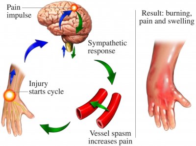 #CRPS: Get pt's out of 'fight/flight', work with the limbic system &amp; break the pain loop. It can be done. #HCT @ AdvancedPathways.com