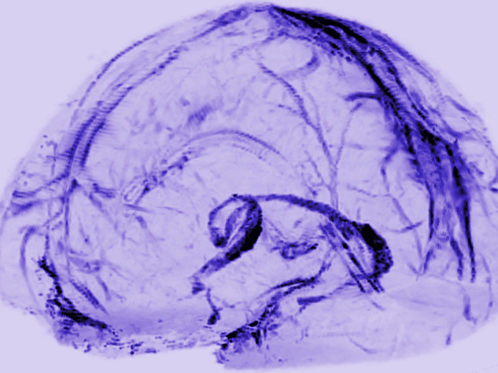 ydeopinion's tweet photo. Confirmado: El cerebro también tiene vasos linfáticos para procesar los residuos: https://t.co/C8zBQ0MTGm #ciencia https://t.co/oxwhvKnUvM