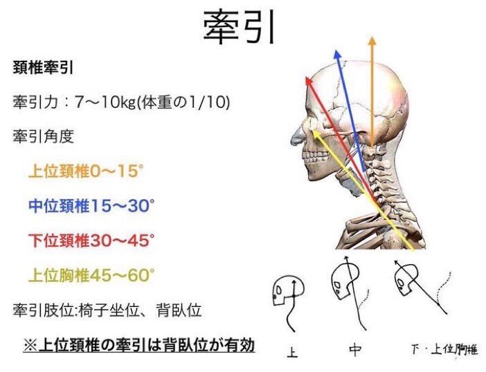下位頸椎への牽引】 頸椎牽引は、 目的となる椎骨の高さに合わせ、牽引