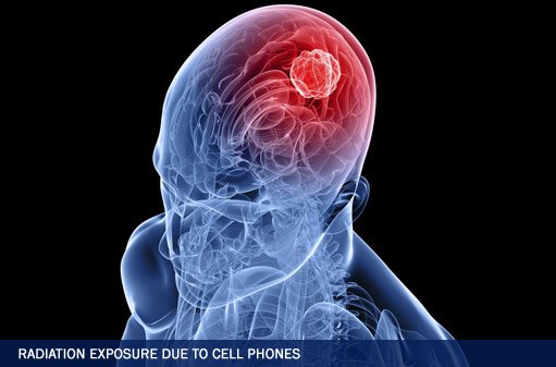 berkeleyprc's tweet photo. Glioblastoma brain cancer increases in non-Hispanic Whites in SF Bay Area from 1988-2013. https://t.co/NhGjG3fS8U https://t.co/nU6WVRQ5Ss