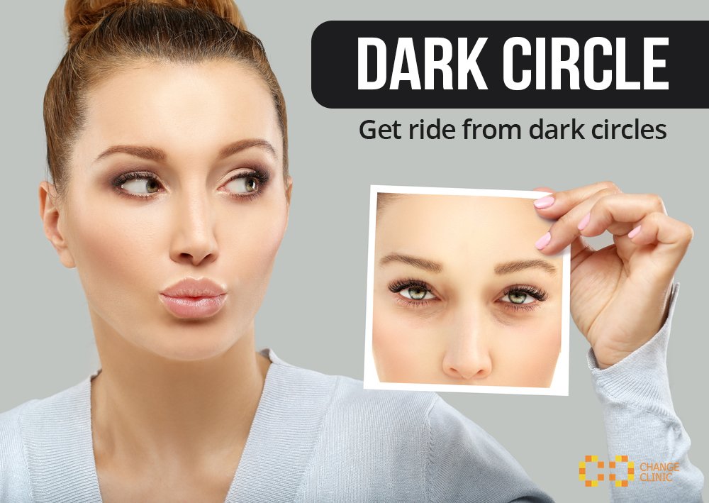 changeclinickr's tweet photo. #Dark_circle
Details: https://t.co/hxQ2Ll6xmi https://t.co/oym0IqDXlP