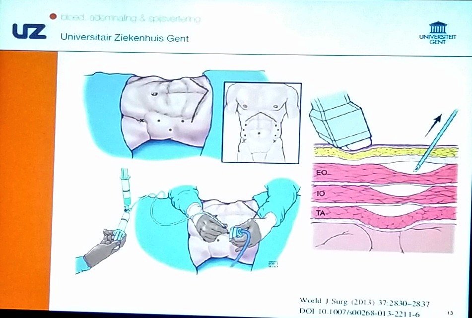 hgok's tweet photo. Frederik Berrevoet from Belgium 🇧🇪 #Botox & #PPP before #AWR
#UFK2017 #FıtıkCerrahisi #HerniaSurgery https://t.co/Y0yGaoRxV9 https://t.co/bRPaXsu7MD