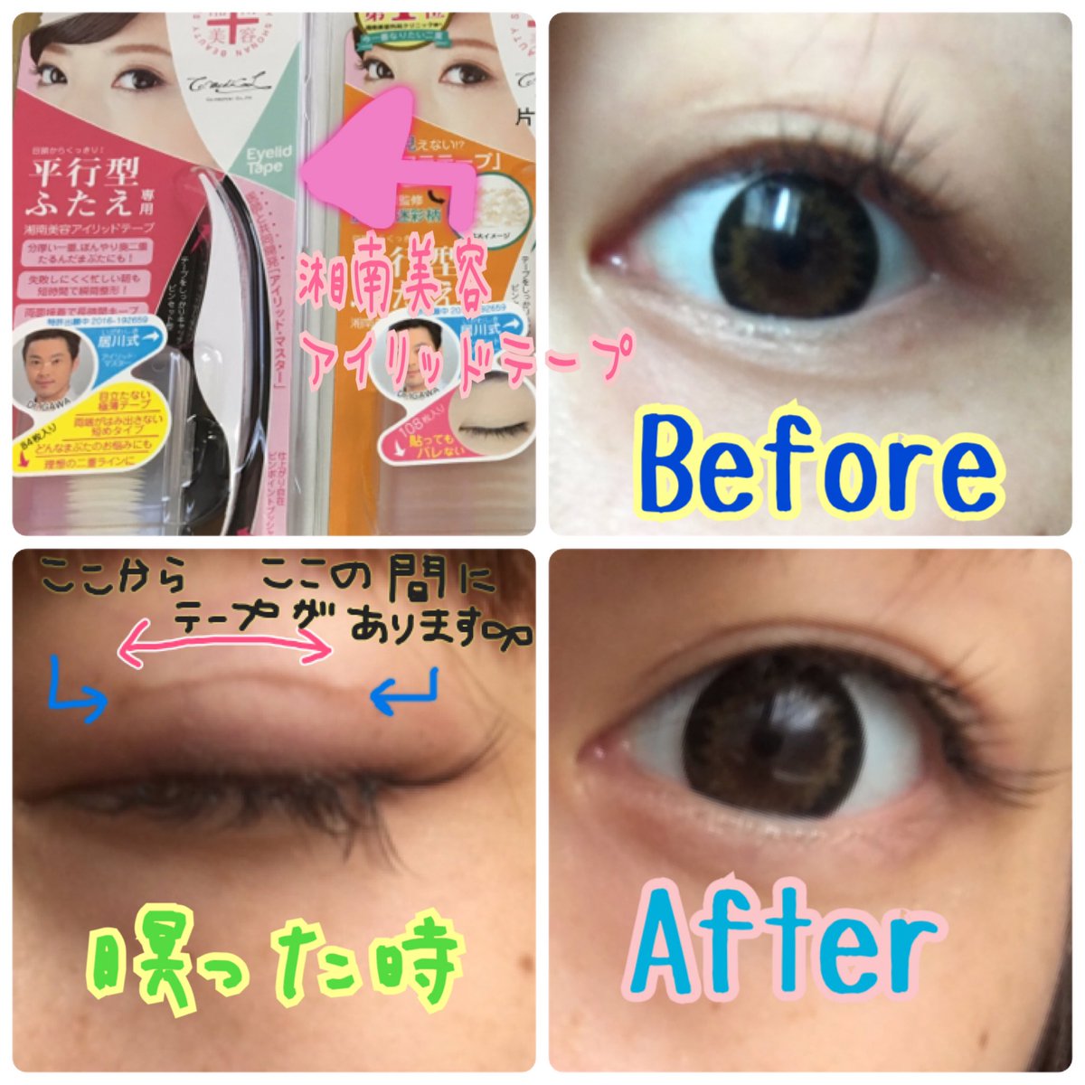 アイリッドテープ Traola Twitterren