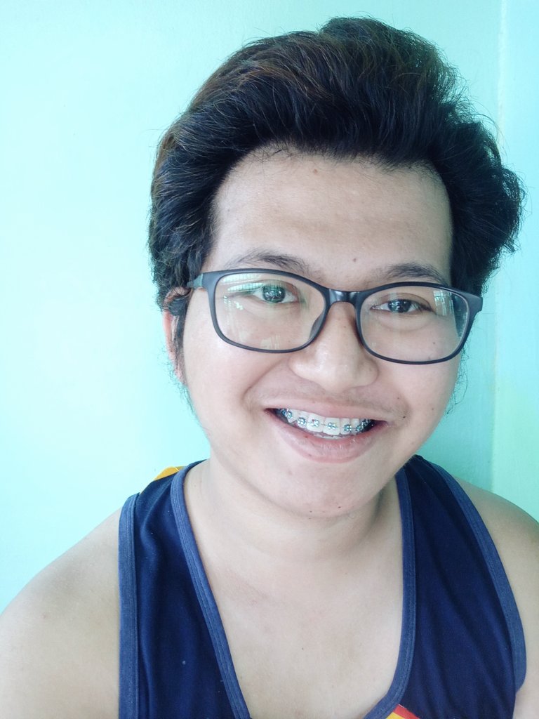 DearJacques's tweet photo. #HelloBraces
(Not pamporma, beshie.) https://t.co/Ao7wUy0xMg