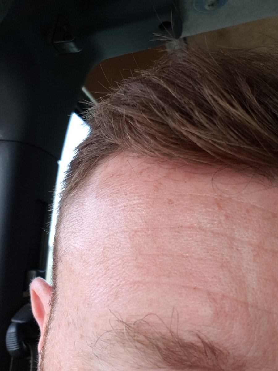 longshlong501's tweet photo. I've really gotta sort me eyebrows out when I get home #bushy #wild #notonpoint 😂 https://t.co/3C3BJJKdDI