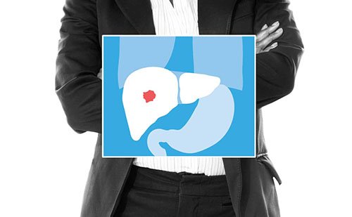 Checkpoint #immunotherapy approved for Patients with liver cancer. #livercancerawareness bit.ly/2hwQ6IQ