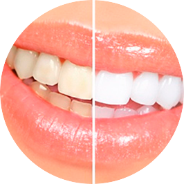 ElQuirinal's tweet photo. #FelizSabado Podrás tener con 1 o 2 #tratamientos la #Sonrisa 😁 que siempre has deseado→ https://t.co/yVbAyXwsCS https://t.co/i0BB8cz683
