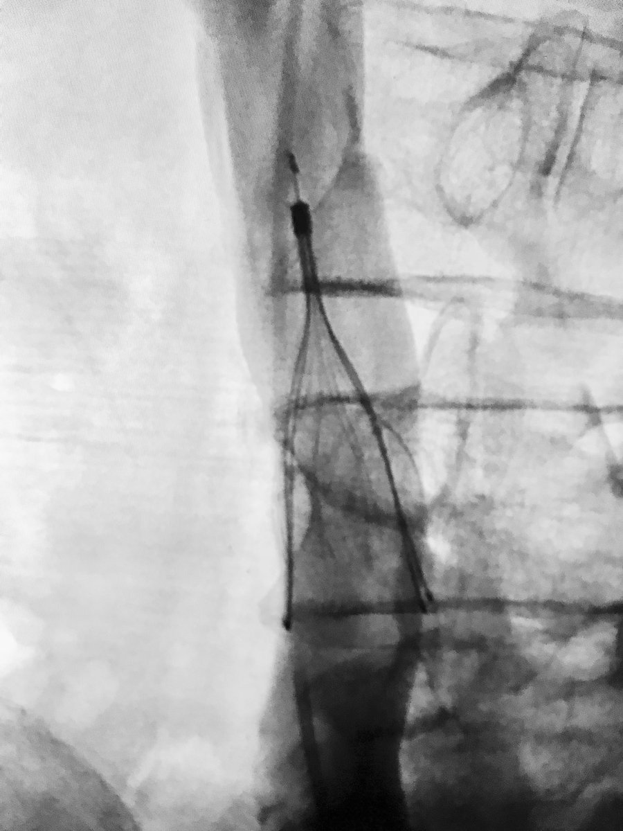 AlexCVIR's tweet photo. #filterout Friday. #IRad #GTFO @SIRspecialists #ACTiVE17 https://t.co/luUN0Dfc5h