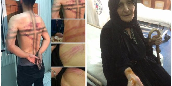 OhalKaldırılmalı Çünkü bu görüntüler ülkemize yakışmıyor.
<a href="/asliaydintasbas/">asli aydintasbas</a>