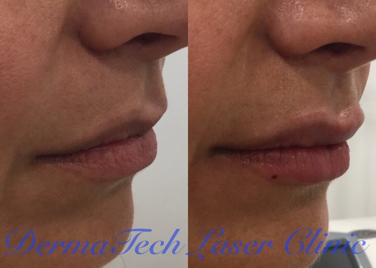 derma_tech tweet picture