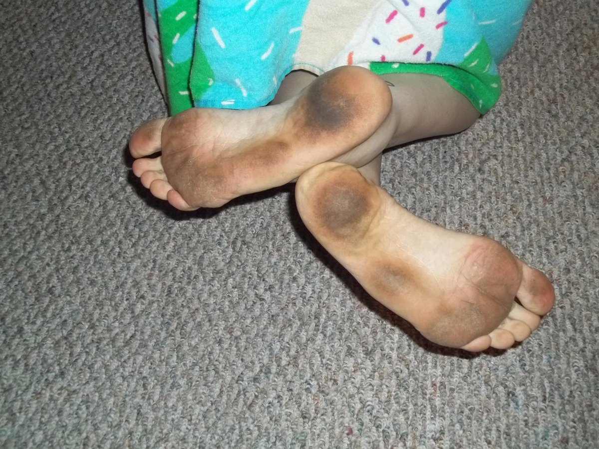 Undine69's tweet photo. They call these Flinstones where I'm from.
#FeetsFriday #dirtyfeet #lickfeet #feetslaves https://t.co/fsSxrkQgPC