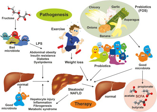 Фруктоза и печень. Печень и микробиота. Gut microbiota NAFLD. Плакат дислипидемия.